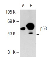  p53 (80): sc-136023. Western blot analysis of p53 expression in non-transfected: sc-117752 (A) and human p53 transfected: sc-158802 (B) 293T whole cell lysates.