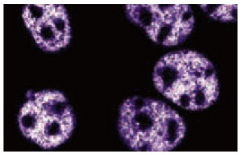  p53 (80): sc-136023. Immunofluorescence staining of A-431 cells showing nuclear localization.