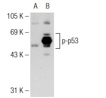  p-p53 (59.Ser 315): sc-135772. Western blot analysis of p53 phosphorylation in non-transfected: sc-117752 (A) and human p53 transfected: sc-158802 (B) 293T whole cell lysates.