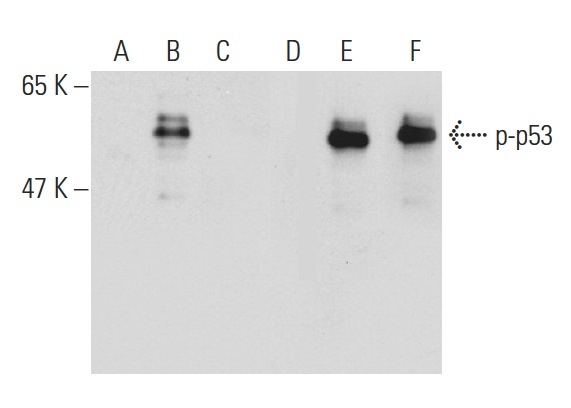  Western blot analysis of p53 phosphorylation in non-transfected: sc-117752 (A,D), untreated human p53 transfected: sc-158802 (B,E) and lambda protein phosphatase treated human p53 transfected: sc-158802 (C,F) 293T whole cell lysates. Antibodies tested include p-p53 (59.Ser 315): sc-135772 (A,B,C) and p53 (Pab 240): sc-99 (D,E,F).