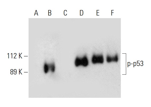  Western blot analysis of p53 phosphorylation in untreated (A,D), CK2a1 treated (B,E) and CK2a1 and lambda protein phosphatase (sc-200312A) treated (C,F) p53 fusion proteins. Antibodies tested include p-p53 (D-9): sc-377567 (A,B,C) and p53 (Pab 240): sc-99 (D,E,F).