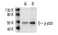  p-p53 (hSer 20)-R: sc-18079-R. Western blot analysis of p53 phosphorylation in untreated (A) and UV-treated (B) COS whole cell lysates.