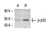  p-p53 (mSer 20)-R: sc-18078-R. Western blot analysis of p53 phosphorylation in untreated (A) and UV-treated (B) COS whole cell lysates.