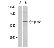  p-p53 (Ser 15): sc-101762. Western blot analysis of phosphorylated p53 expression in untreated (A) and hydroxyurea-treated (B) HeLa whole cell lysates.