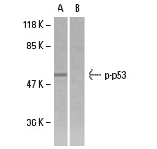  Western blot analysis of phosphorylated Flk-1 expression in SK-OV-3 whole cell lysates. Blots were probed with p-Flk-1 (Tyr 1214): sc-101820 (A) and p-Flk-1 (Tyr 1214): sc-101820 preincubated with cognate phosphorylated peptide (B). 