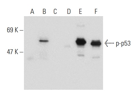  Western blot analysis of p53 phosphorylation in non-transfected: sc-117752 (A,D), untreated human p53 transfected: sc-158802 (B,E) and lambda protein phosphatase (sc-200312A) treated human p53 transfected: sc-158802 (C,F) 293T whole cell lysates. Antibodies tested include p-p53 (Ser 315): sc-101763 (A,B,C) and p53 (Pab 240): sc-99 (D,E,F).