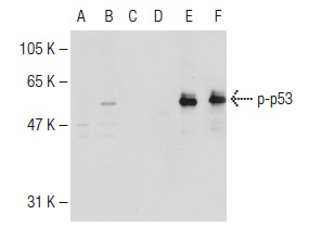  Western blot analysis of p53 phosphorylation in non-transfected: sc-117752 (A,D), untreated human p53 transfected: sc-158802 (B,E) and lambda protein phosphatase treated human p53 transfected: sc-158802 (C,F) 293T whole cell lysates. Antibodies tested include p-p53 (Ser 315): sc-101763 (A,B,C) and p53 (Pab 240): sc-99 (D,E,F).