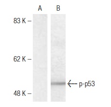  p-p53 (Ser 33): sc-135632. Western blot analysis of phosphorylated p53 expression in untreated (A) and UV-treated (B) HT-29 cell extracts.