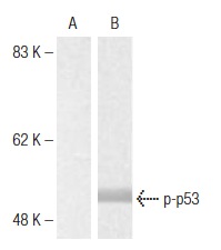  p-p53 (Ser 37): sc-135633. Western blot analysis of phosphorylated p53 expression in untreated (A) and Doxorubicin-treated (B) HT-29 cell extracts.