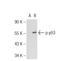  p-p53 (Ser 392): sc-7997. Western blot analysis of p53 phosphorylation in non-transfected: sc-117752 (A) and human p53 transfected: sc-158802 (B) 293T whole cell lysates.