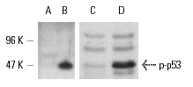  Western blot analysis of p53 phosphorylation in untreated (A,C) and etoposide-treated (B,D) MCF7 cell cultures. Antibodies tested include p-p53 (Ser 392)-R: sc-7997-R (A,B) and p-p53 (Ser 15)-R: sc-11764-R (C,D).