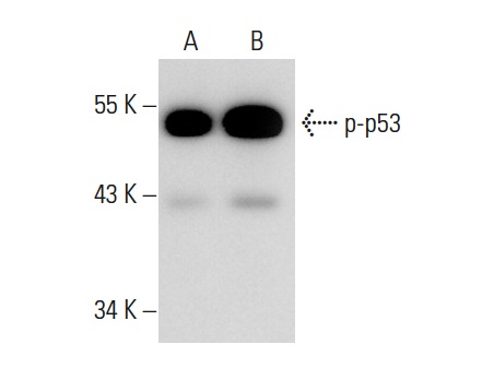  p-p53 (Ser 392)-R: sc-7997-R. Western blot analysis of p53 phosphorylation in non-transfected: sc-117752 (A) and mouse p53 transfected: sc-125766 (B) 293T whole cell lysates.