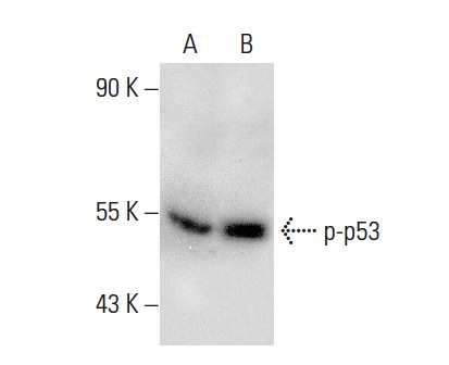  p-p53 (Ser 392): sc-7997. Western blot analysis of p53 phosphorylation in non-transfected: sc-117752 (A) and mouse p53 transfected: sc-125766 (B) 293T whole cell lysates.