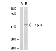  Western blot analysis of phosphorylated p53 expression in 293 whole cell lysates. Antibodies tested include p-p53 (Ser 46): sc-101764 preincubated with cognate phosphorylated peptide (A) and p-p53 (Ser 46): sc-101764 (B). 