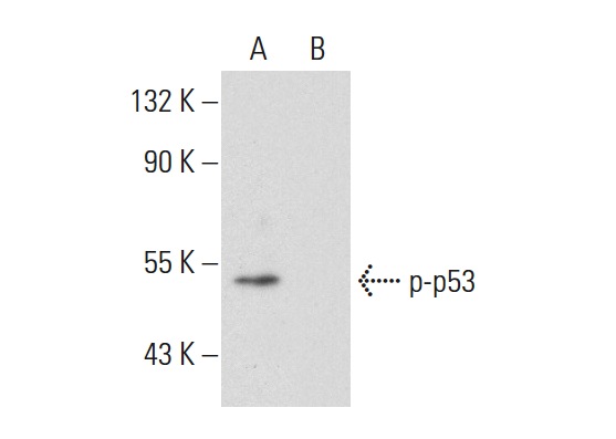  p-p53 (Ser 46): sc-101764. Western blot analysis of p53 phosphorylation in untreated (A) and lambda protein phosphatase treated (B) HEK293 whole cell lysates.