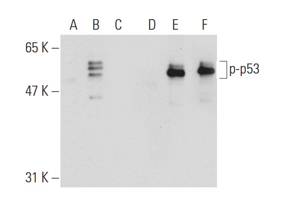  Western blot analysis of p53 phosphorylation in non-transfected: sc-117752 (A,D), untreated human p53 transfected: sc-158802 (B,E) and lambda protein phosphatase treated human p53 transfected: sc-158802 (C,F) 293T whole cell lysates. Antibodies tested include p-p53 (Ser 46): sc-101764 (A,B,C) and p53 (Pab 240): sc-99 (D,E,F).