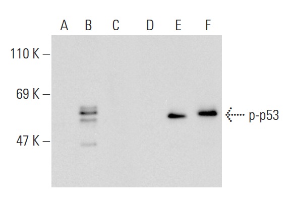  Western blot analysis of p53 phosphorylation in non-transfected: sc-117752 (A,D), untreated human p53 transfected: sc-158802 (B,E) and lambda protein phosphatase treated human p53 transfected: sc-158802 (C,F) 293T whole cell lysates. Antibodies tested include p--p53 (Ser 46): sc-101764 (A,B,C) and p53 (Pab 240): sc-99 (D,E,F).