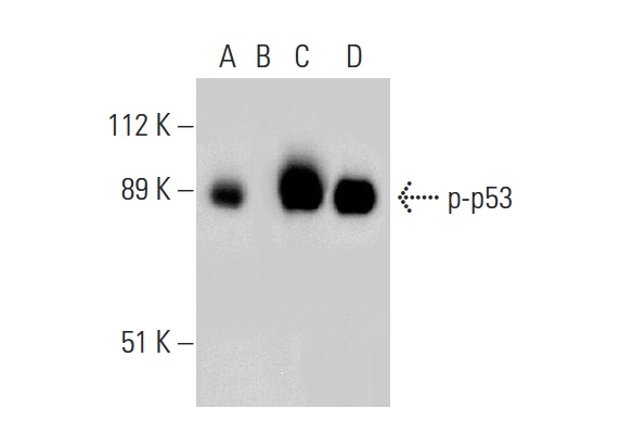  Western blot analysis of p53 phosphorylation in untreated (A,C) and lambda protein phosphatase (sc-200312A) treated (B,D) human recombinant p53. Antibodies tested include p-p53 (Ser 46): sc-101764 (A,B) and p53 (Pab 240): sc-99 (C,D).