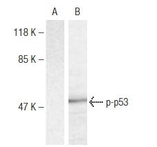  p-p53 (Ser 6): sc-135630. Western blot analysis of phosphorylated p53 expression in untreated (A) and UV-treated (B) HT-29 cell extracts.