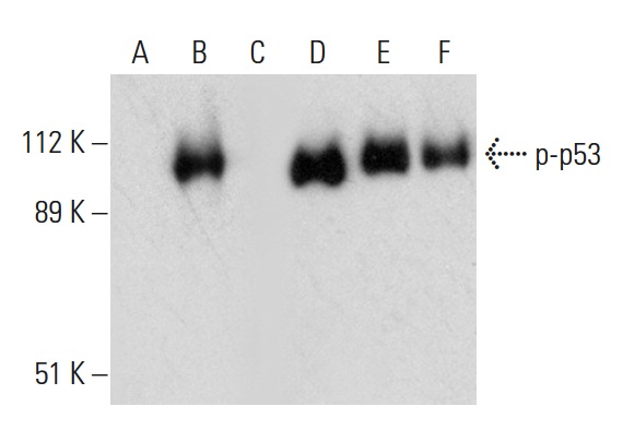  Western blot analysis of p53 phosphorylation in untreated (A,D), CK2a1 treated (B,E) and CK2a1 and lambda protein phosphatase (sc-200312A) treated (C,F) p53 fusion proteins. Antibodies tested include p-p53 (Thr 155): sc-17105 (A,B,C) and p53 (Pab 240): sc-99 (D,E,F).