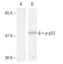  p-p53 (Thr 18): sc-135631. Western blot analysis of phosphorylated p53 expression in untreated (A) and hydroxyurea-treated (B) HT-29 cell extracts.