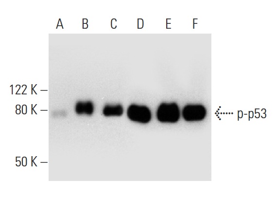  Western blot analysis of p53 phosphorylation in untreated (A,D), CHK 1 treated (B,E) and DNA-PK treated (C,F) p53 recombinant proteins. Antibodies tested include p-p53 (Thr 18): sc-135631 (A,B,C) and p53 (Pab 240): sc-99 (D,E,F).