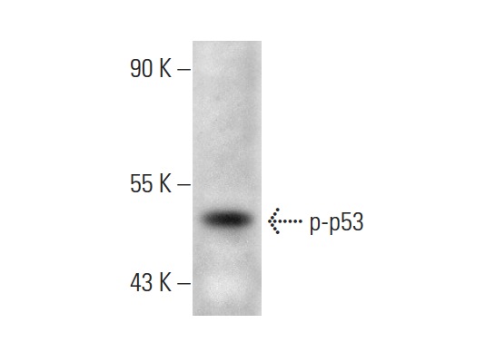  p-p53 (Thr 18)-R: sc-16716-R. Western blot analysis of p53 phosphorylation in A-431 whole cell lysate.