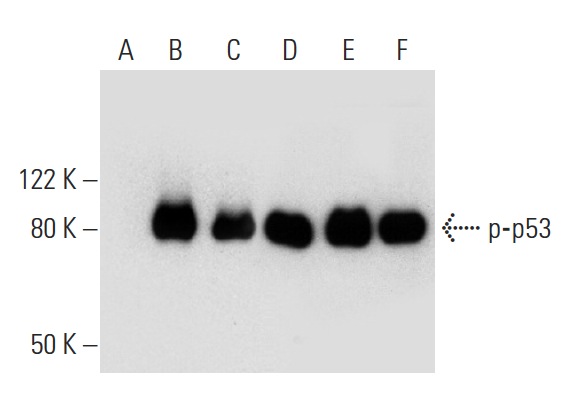  Western blot analysis of p53 phosphorylation in untreated (A,D), CHK 1 treated (B,E) and DNA-PK treated (C,F) p53 recombinant proteins. Antibodies tested include p-p53 (Thr 18)-R: sc-16716-R (A,B,C) and p53 (Pab 240): sc-99 (D,E,F).