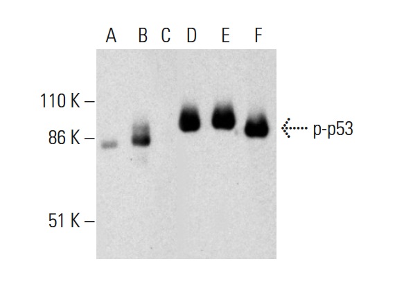  Western blot analysis of p53 phosphorylation in untreated (A,D), ERK2 treated (B,E) and ERK2 and lambda protein phosphatase (sc-200312A) treated (C,F) human recombinant p53. Antibodies tested include p-p53 (Thr 55)-R: sc-12904-R. (A,B,C) and p53 (Pab 240): sc-99 (D,E,F).