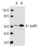  p-p53 (FP3.2): sc-51690. Western blot analysis of p53 phosphorylation expression in untreated (A) and EGF treated (B) A-431 whole cell lysates.