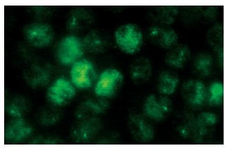  p-p53 (FP3.2): sc-51690. Immunofluorescence staining of methanol-fixed EGF-treated A-431 cells showing nuclear localization.