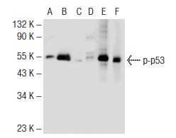  Western blot analysis of p53 phosphorylation in non-transfected: sc-117752 (A, D), untreated mouse p53 transfected: sc-125766 (B, E) and lambda protein phosphatase treated mouse p53 transfected: sc-125766 (C, F) 293T whole cell lysates.  Antibodies tested include p-p53 (FP3.2): sc-51690 (A, B, C) and p53 (M-19): sc-1312 (D, E, F).