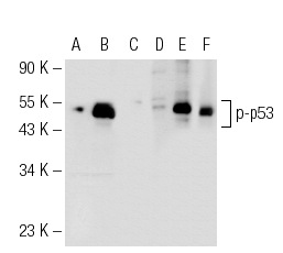  Western blot analysis of p53 phosphorylation in non-transfected: sc-117752 (A, D), untreated mouse p53 transfected: sc-125766 (B, E) and lambda protein phosphatase treated mouse p53 transfected: sc-125766 (C, F) 293T whole cell lysates.  Antibodies tested include p-p53 (FPS392): sc-56173 (A, B, C) and p53 (M-19): sc-1312 (D, E, F).