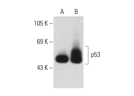  p-p53 (5G176): sc-71785. Western blot analysis of p53 phosphorylation in non-transfected: sc-117752 (A) and human p53 transfected: sc-158802 (B) 293T whole cell lysates.