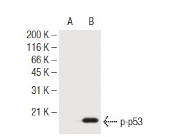  p-p53 (9F4): sc-81511. Western blot analysis of phosphorylated recombinant C-terminal fragment of p53 incubated with Casein Kinase II in the absence (A) or presence (B) of ATP.