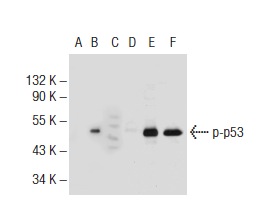  Western blot analysis of p53 phosphorylation in non-transfected: sc-117752 (A, D), untreated mouse p53 transfected: sc-125766 (B, E) and lambda protein phosphatase treated mouse p53 transfected: sc-125766 (C, F) 293T whole cell lysates. Antibodies tested include p-p53 (9F4): sc-81511 (A, B, C) and p53 (M-19): sc-1312 (D, E, F).