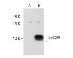  p53CSV (C-17): sc-139544. Western blot analysis of p53CSV expression in non-transfected: sc-117752 (A) and mouse p53CSV transfected: sc-122332 (B) 293T whole cell lysates.