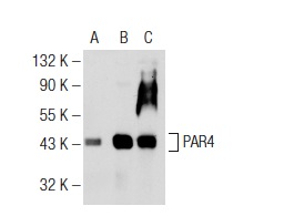  PAR4 (R-334): sc-1807. Western blot analysis of PAR4 expression in non-transfected 293: sc-110760 (A), mouse PAR4 transfected 293: sc-179292 (B) and NIH/3T3 (C) whole cell lysates.