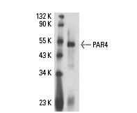  PAR4 (R-334): sc-1807. Western blot analysis of rat recombinant PAR4.