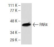  PAR4 (C-19): sc-1249. Western blot analysis of PAR4 expression in AT-3 whole cell lysate.