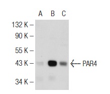  PAR4 (C-19): sc-1249. Western blot analysis of PAR4 expression in non-transfected 293: sc-110760 (A), mouse PAR4 transfected 293: sc-179292 (B) and NIH/3T3 (C) whole cell lysates.