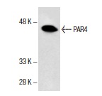  PAR4 (A-10): sc-1666. Western blot analysis of PAR4 expression in AT-3 whole cell lysate.