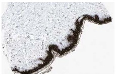  PAR4 (A-10): sc-1666. Immunoperoxidase staining of formalin fixed, paraffin-embedded human skin tissue showing cytoplasmic and membrane staining of epidermal cells. Kindly provided by The Swedish Human Protein Atlas (HPA) program.