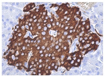  PAR4 (A-10): sc-1666. Immunoperoxidase staining of formalin fixed, paraffin-embedded human pancreas tissue showing cytoplasmic staining of Islets of Langerhans.