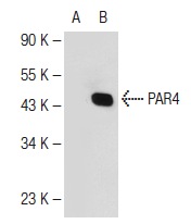  PAR4 (3G9H7): sc-130078. Western blot analysis of PAR4 expression in non-transfected: sc-110760 (A) and mouse PAR4 transfected: sc-179292 (B) 293 whole cell lysates.