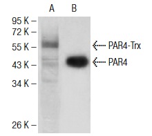  PAR4 (4H12E9): sc-130079. Western blot analysis of full-length human recombinant PAR4-Trx protein (A) and PAR4 expression in HeLa whole cell lysate (B).