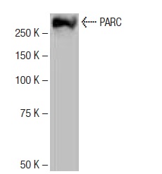  PARC (NQ-C32): sc-134412. Western blot analysis of PARC expression in A-431 whole cell lysate.