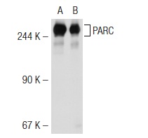  PARC (PO69): sc-53748. Western blot analysis of PARC expression in 293T (A) and HeLa (B) whole cell lysates.