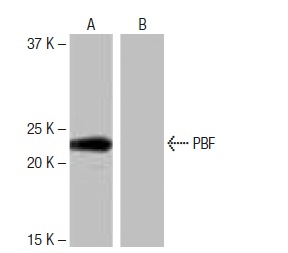  PBF (NB-A25): sc-134414. Western blot analysis of PBF expression in human PBF transfected (A) and non-transfected (B) 293T whole cell lysates.