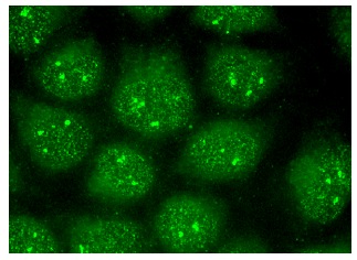  PINX1 (D-3): sc-374113. Immunofluorescence staining of methanol-fixed HeLa cells showing nucleolar and nuclear localization.